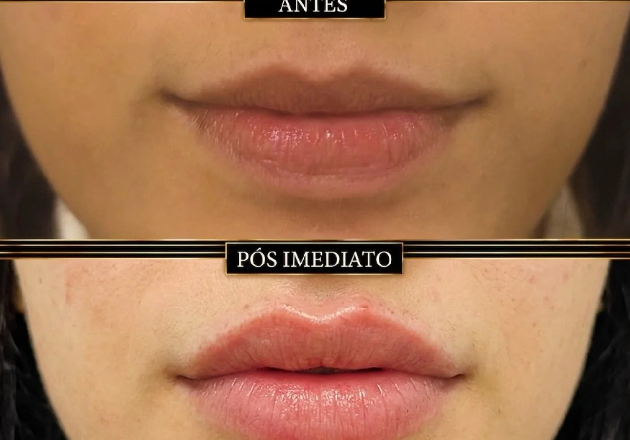 Antes e depois — caso 6