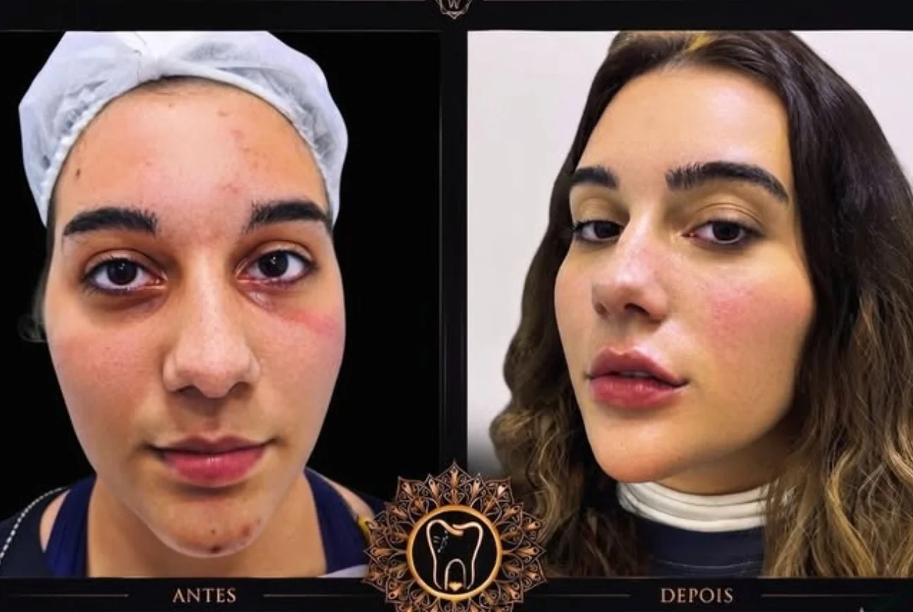 Antes e depois — caso 3