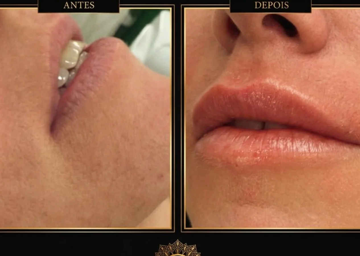 Antes e depois — caso 8