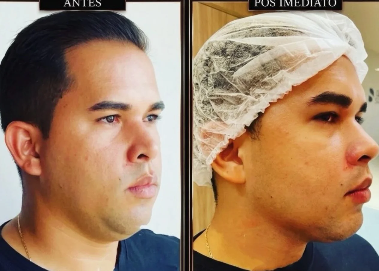 Antes e depois — caso 5