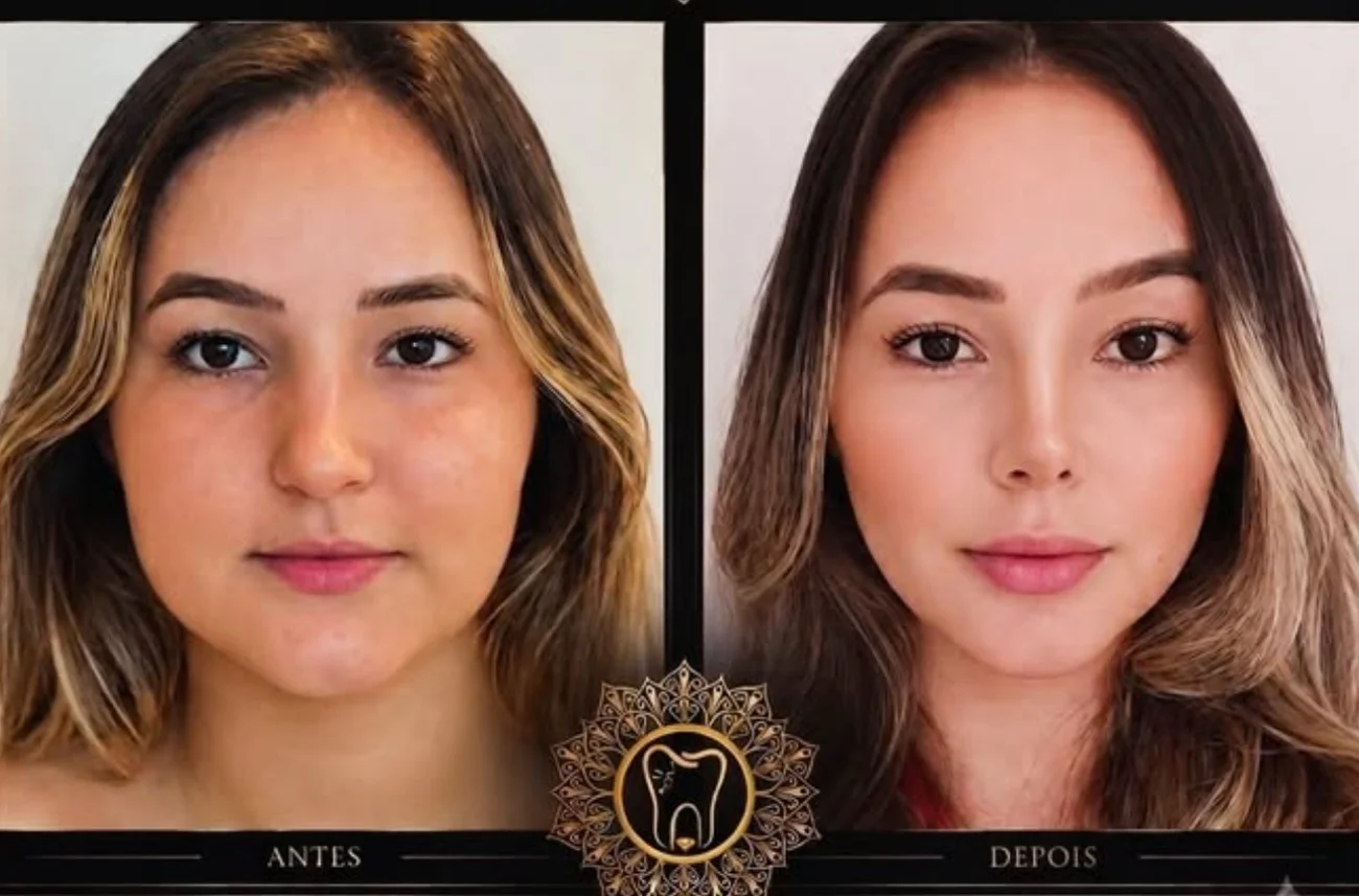Universo Face